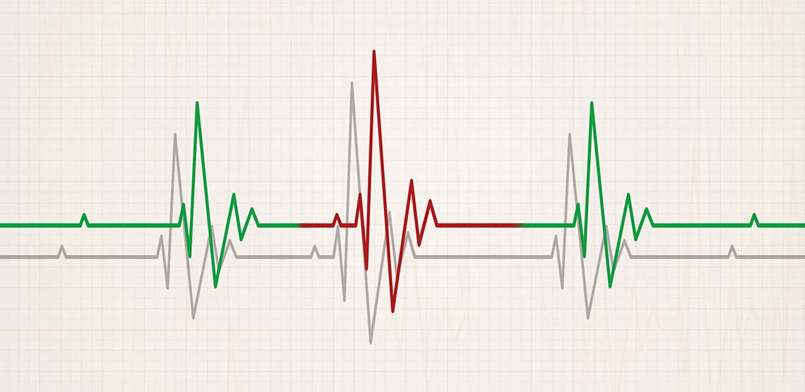 An electrocardiogram heartbeat line.