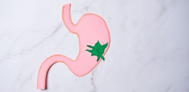 A pink paper cut out of a stomach on a white background. It has a green spot on it to indicate a cancer tumor.